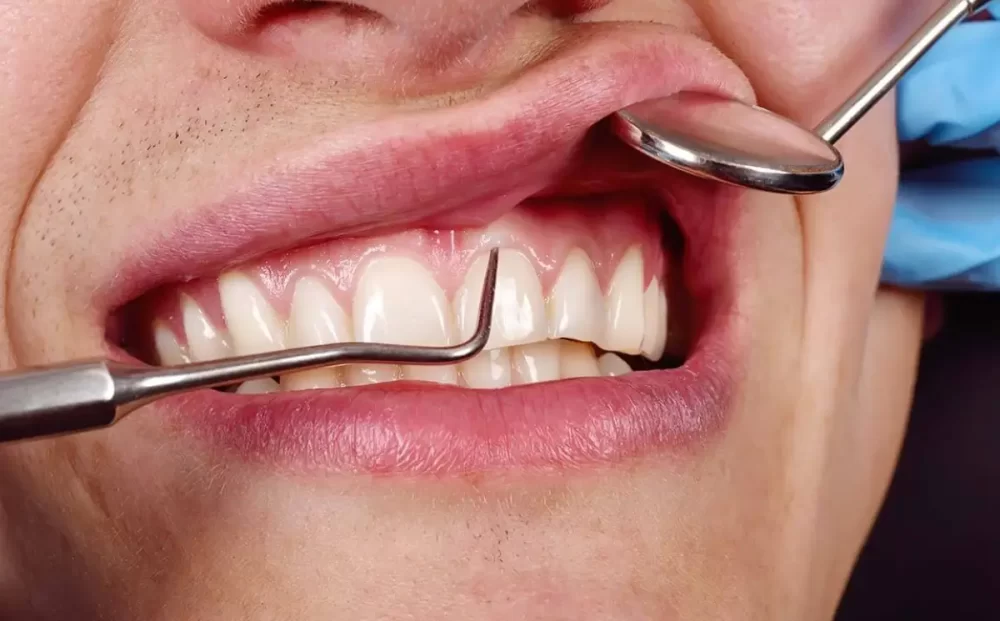 gum-treatment